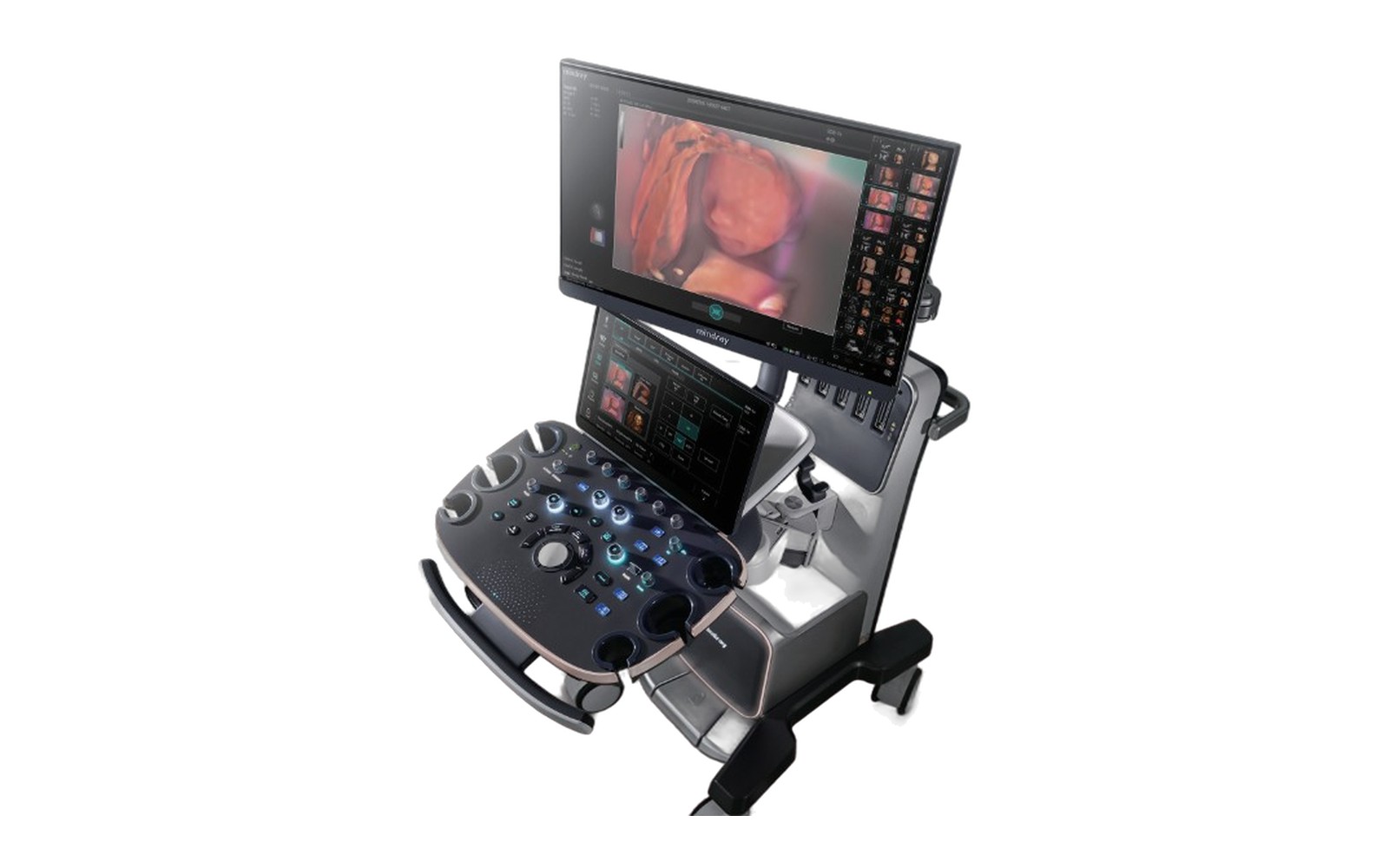 Mindray Nuewa I9 Elite